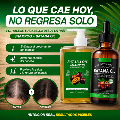 COMBO Anti caida Aceite y shampoo de batana + Guia de REGALO para evitar la caida prematura del cabello.